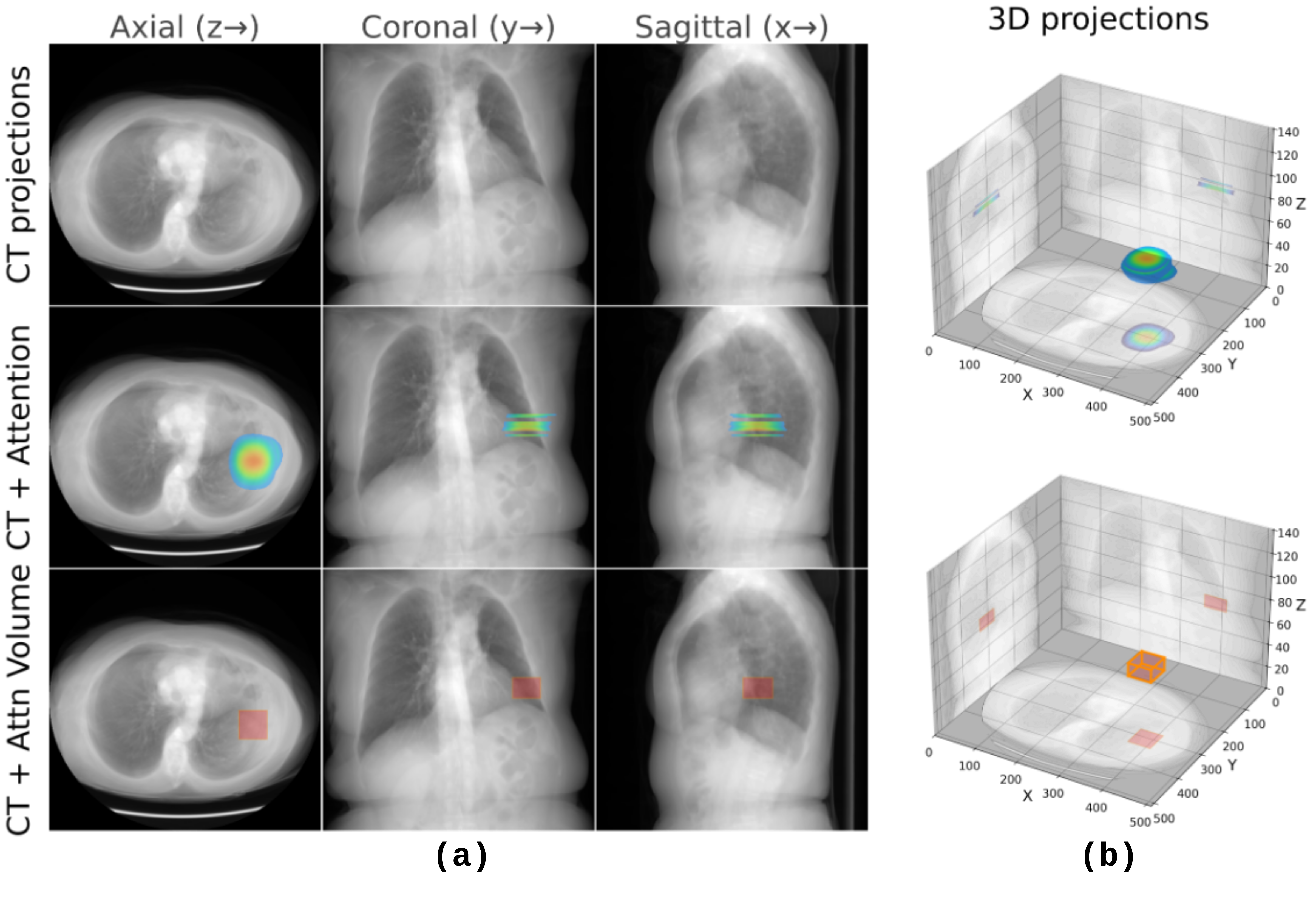 XAI Module output: tri-axial attention projections, 3D heatmap and 3D bounding box