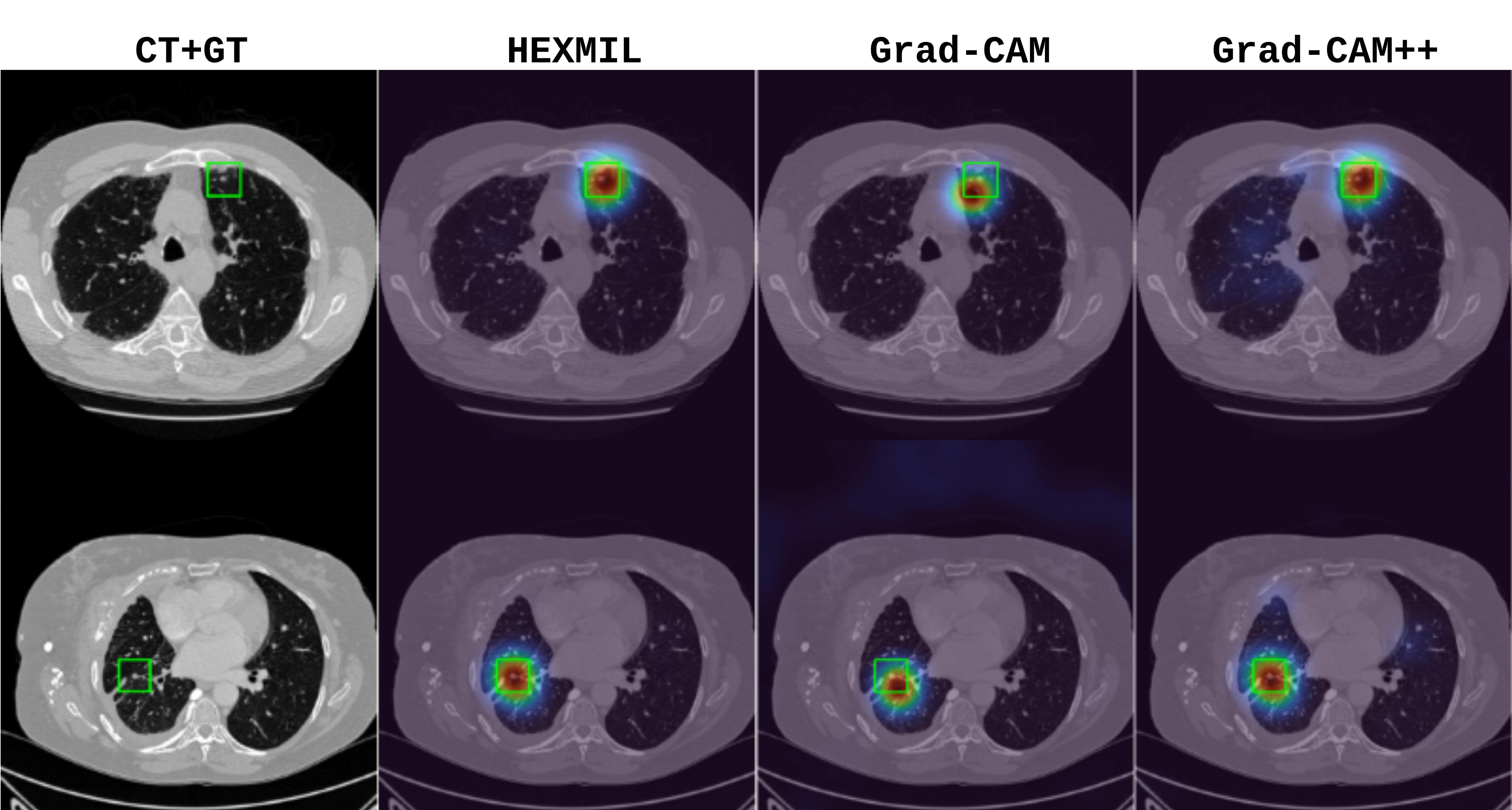 HexMIL attention heatmaps compared to the ground-truth manipulation region